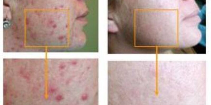 Bava di Lumaca: Proprietà e Benefici per la Pelle | Guida Completa